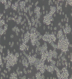 YAC-1小鼠淋巴瘤細胞主圖