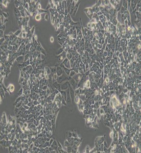 LoVo人結腸癌細胞主圖