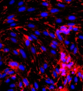 大鼠腦微血管內(nèi)皮細(xì)胞主圖