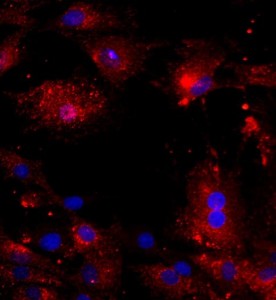 大鼠椎間盤纖維環(huán)細(xì)胞主圖