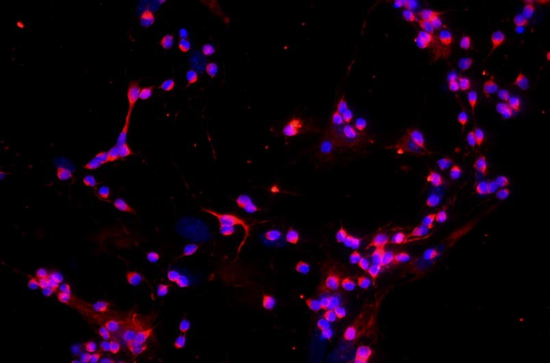 小鼠視網膜神經節細胞主圖