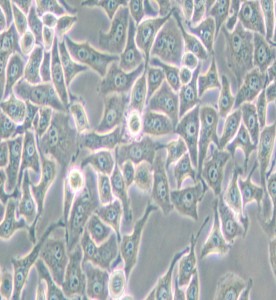 Hela-S3人宮頸癌細胞主圖