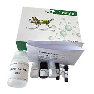 Annexin V-FITC細胞凋亡檢測試劑盒(TMR紅色熒光)主圖